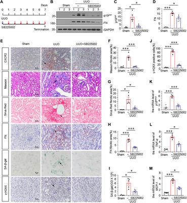 CXC Chemokine Receptor 2 Accelerates Tubular Cell Senescence and Renal Fibrosis via β-Catenin-Induced Mitochondrial Dysfunction